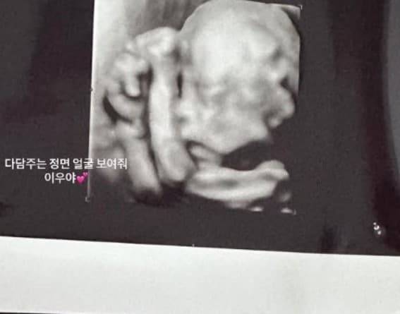 지드래곤 근황