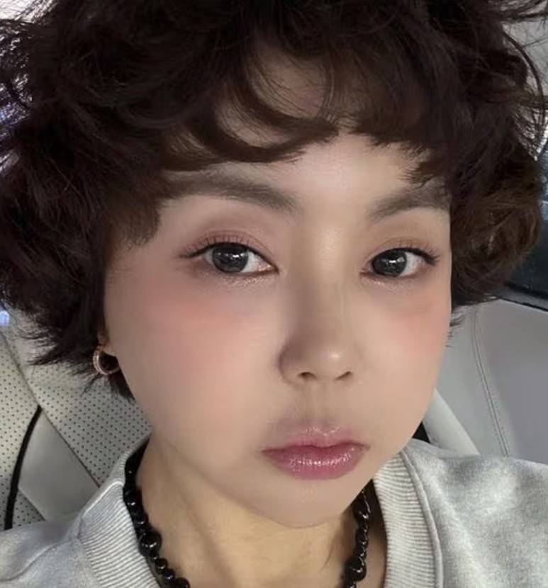 황혜영 뇌수막종 투병