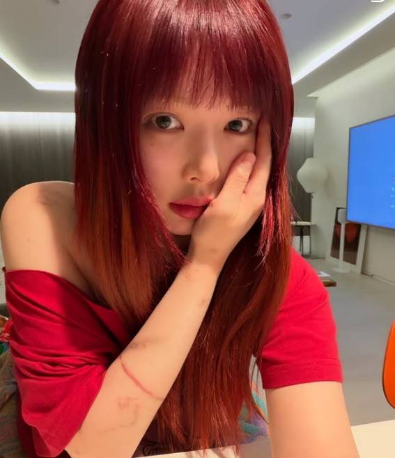 현아 용준형
